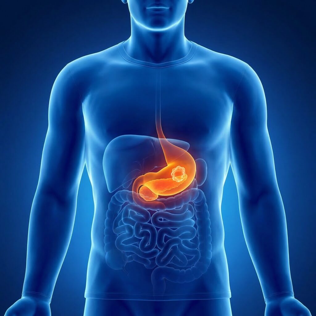 Suspected cancer: recognition and referral: MedDigest Summary of NICE NG12